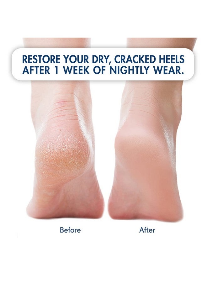 Esbriet Original Moisturizing Heel Socks for Cracked Heel Treatment - 2 Pairs - Stop Cracked Heels in Their Tracks - Image 3