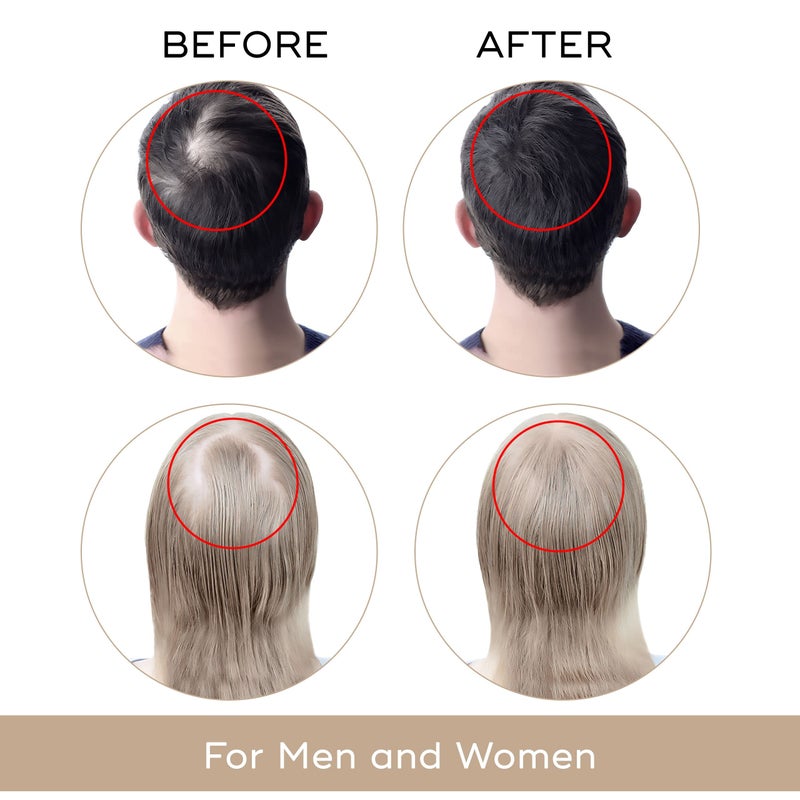 Charismo USA Dekohair Hair Regrowth Serum - Stops Hair Thinning, Promotes Growth, Increases Root Volume - Image 3