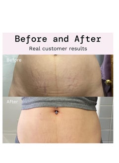 Rosarden Stretch Mark Prevention Cream for Pregnancy, Stretch Mark Cream Remover, Stretch Mark Lotion for Pregnancy, Tummy Butter for Stretch Marks Pregnancy, Shea Butter Stretch Mark Removal Cream  - Image 5