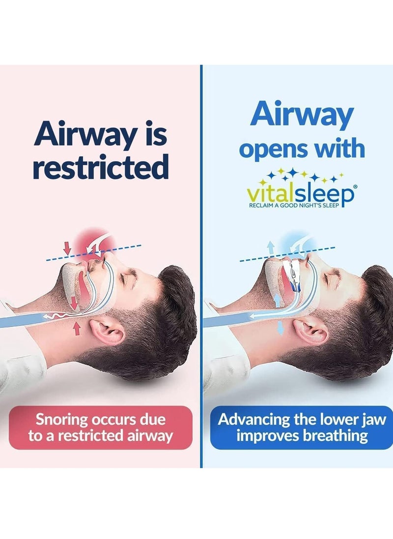 Anti snoring Device Mouthpiece, Upgraded Adjustable Mouthpiece Silicone Snore Stopper, Help Sleep at Night, Prevent Snoring and Snoring, Anti Teeth Grinding Corrective Snore Stopper, Teeth Grinding Mouthguard