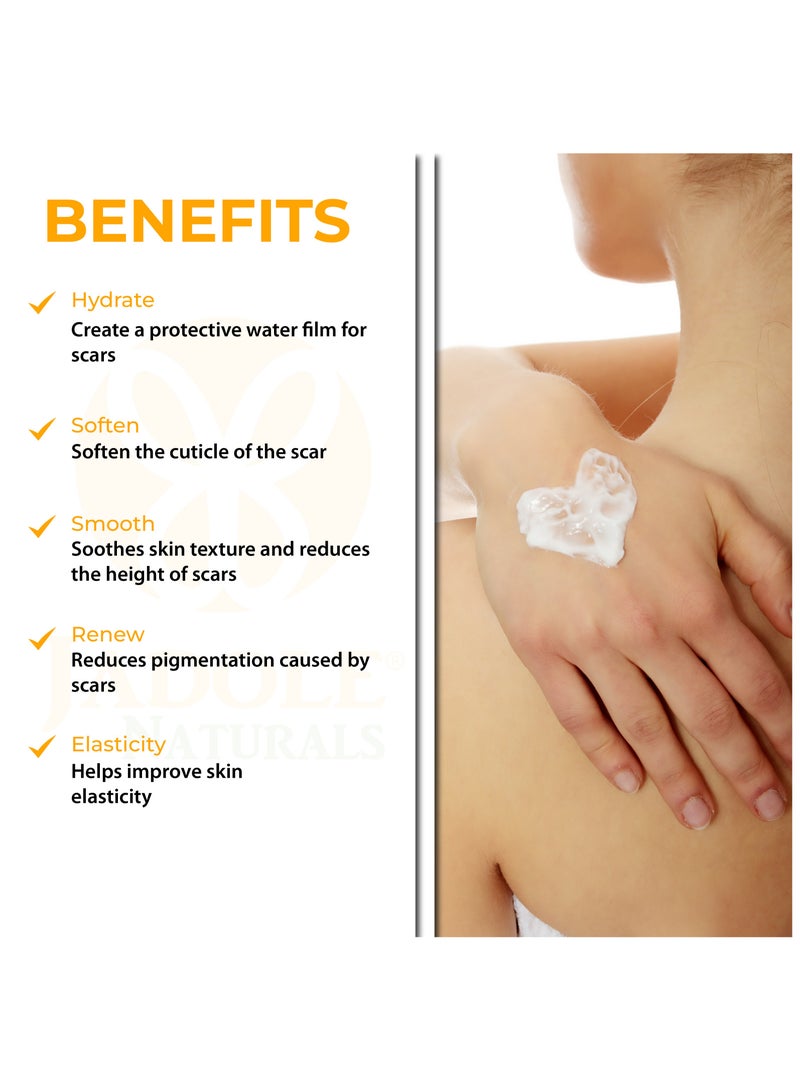 جادول ناتشورالز كريم علامات التمدد - 120 جرام، مُركّب من زيت الجوجوبا والكاكاو وزبدة الشيا - Image 2