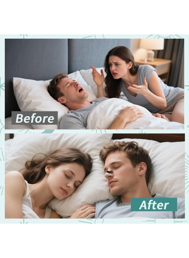 ZESTU Nasal Strips Starter Kit (45 ct, Black) – Extra Strength Snoring Relief, Enhanced Breathing & Sleep Quality – Boosts Oxygen, Sweat-Resistant & Skin-Friendly for Better Comfort - Image 2