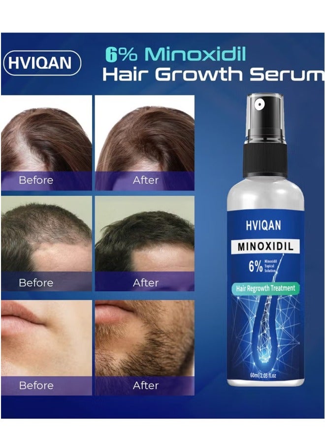 هفيكان 6 ٪ minoxidil شعر كثيف الرذاذ الرش - Image 4