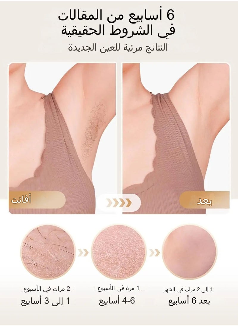 جهاز إزالة الشعر IPL 9 مستويات و999900 ومضة إزالة الشعر بالليزر المنزلي الدائم وغير المؤلم للنساء والرجال - pzsku/Z2ADE0B1AF2C21085C057Z/45/_/1729240644/544c6a9f-0fea-48f4-a6ac-a9cd7f2e8c3d