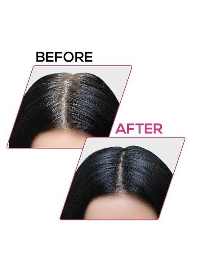 samvarn Hair Powder Black, Helps Cover Grey Roots & Bald Spots Instantly, Highly Pigmented, Fuller and Denser, Long-Lasting & Matte Finish, Super-Fine Powder for Flawless Application (Pack of 1) (S1) - Image 3