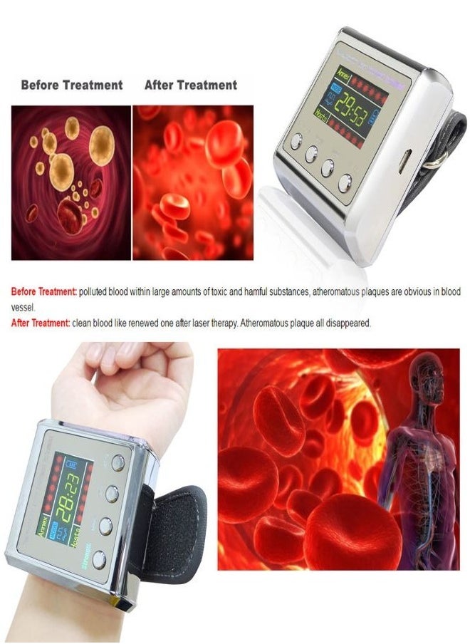 Generic Laser Therapy Watch  - Image 2