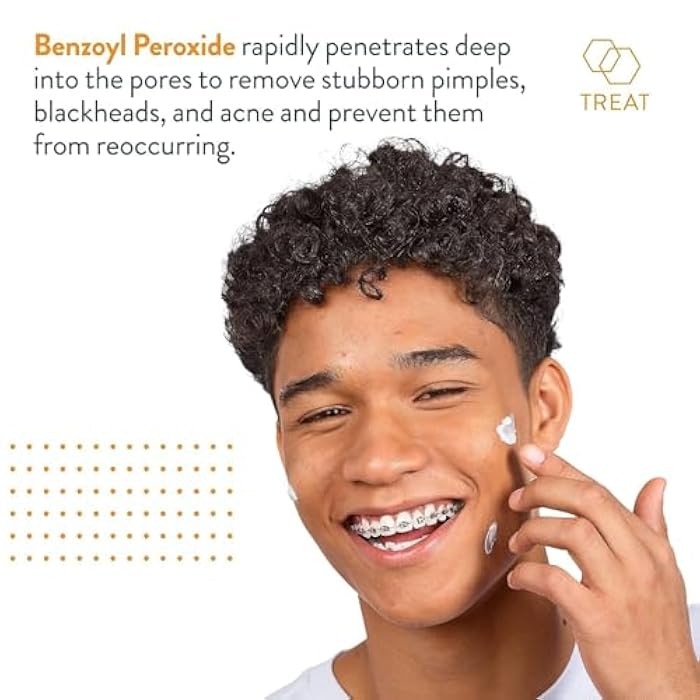 AcneFree Terminator 10 Acne Spot Treatment with Benzoyl Peroxide 10% Maximum Strength Acne Cream Treatment, 1 Ounce - Pack Of 1 - Image 4