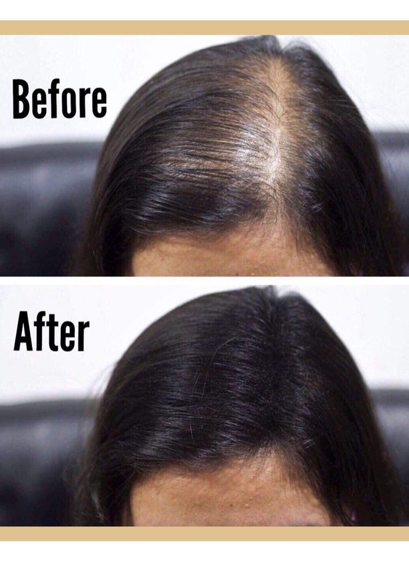 Caboki - Hair Building Fibers Dark Brown 25g Hair Loss Concealer, All-Natural, Make Thin Hair Look 10X Fuller Instantly - Image 1