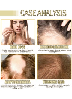 EELHOE 100% Natural Hair Growth Oil – Boost New Hair Growth & Strengthen Follicles with Caffeine, Biotin, Castor, Argan, and Coconut Oils | Effective Hair Mask for Increased Hair Density  - Image 4