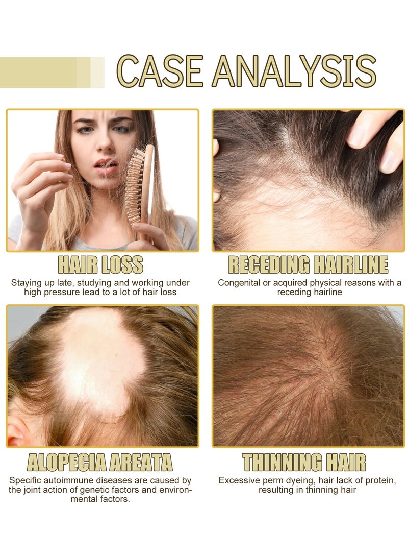 EELHOE Natural Hair Growth Oil – Boost New Hair Growth & Strengthen Follicles with Caffeine, Biotin, Castor, Argan, and Coconut Oils | Effective Hair Mask for Increased Hair Density - Image 4