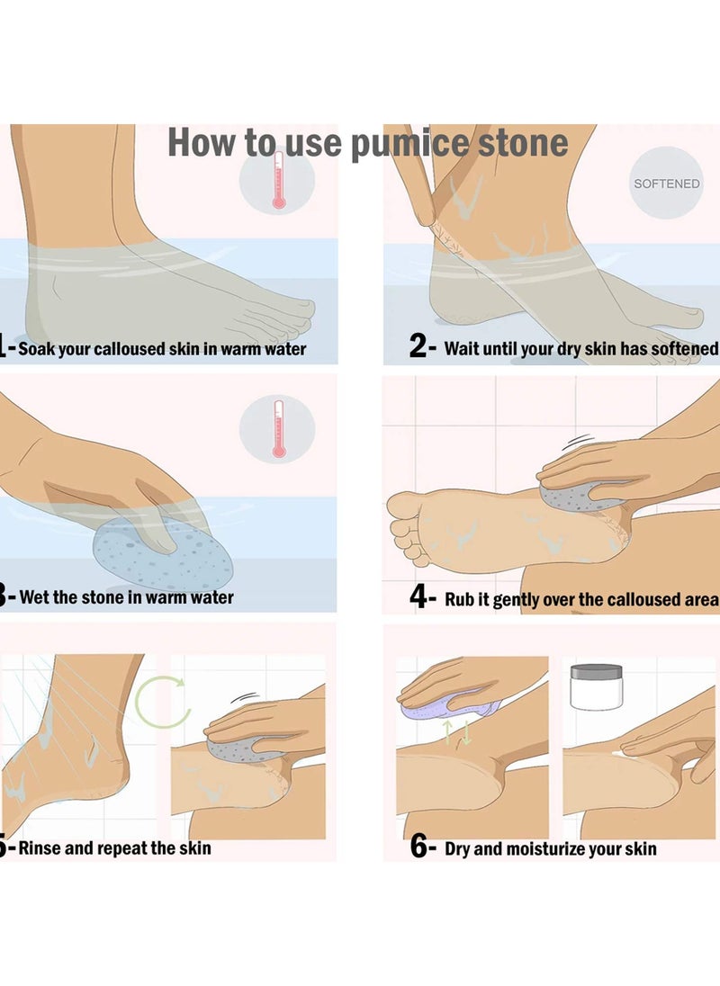 Excefore - Pumice Stone, Callus Remover for Hard and Dead Skins, Foot Scrubber & Pedicure Tools for Men & Women Feet  2Pcs - Image 1