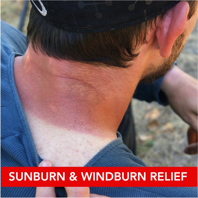 Dermatone Camphor Ice | Skin Balm for Dry, Cracked and Chapped Skin | Lips, Hands, Feet | Skin Irritation Relief | Sunburn | Bug Bites | Minor Burns | Soothing Vapors | Nasal Congestion, 1 oz stick - Image 5