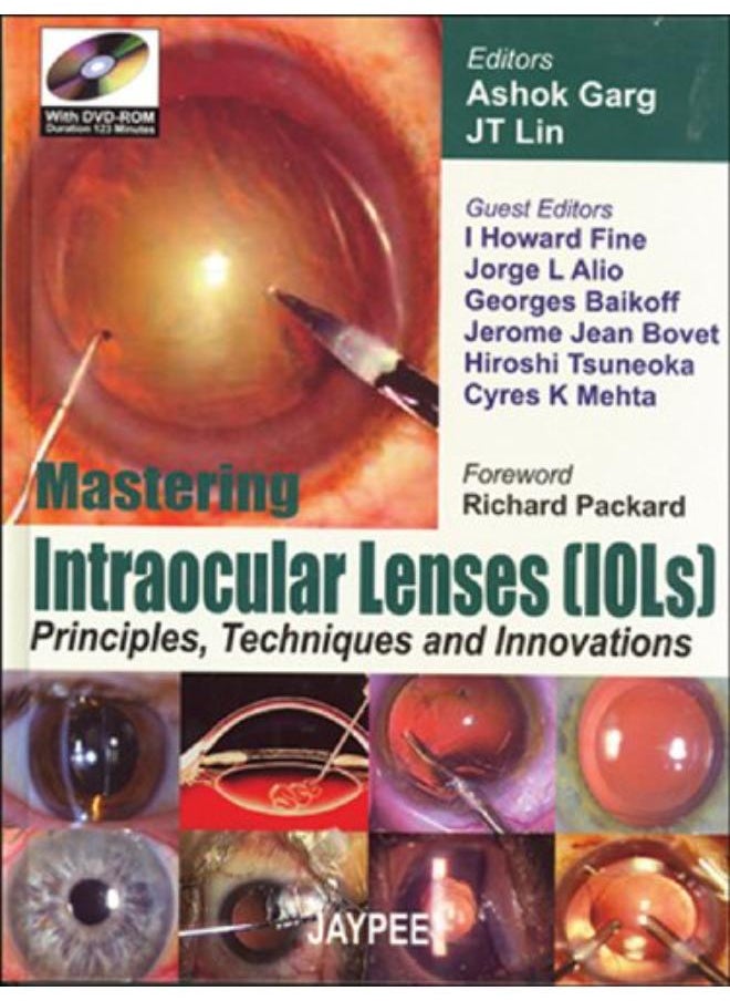 null - Mastering Intraocular Lenses (Iols) Principles, Techniques and Innovations (Four Colour) (With DVD-ROM)(Duration 123 Minutes) - Image 1
