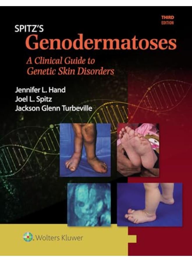 Spitz's Genodermatoses 3e 