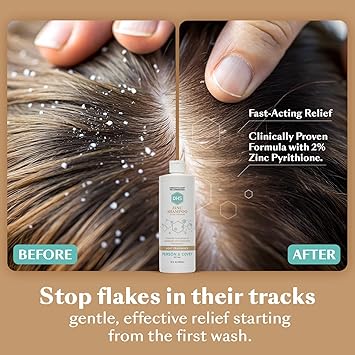 DHS Zinc Shampoo Dhs 16oz - Image 3