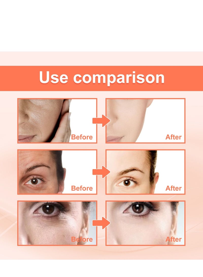 EELHOE Rose oil VC anti wrinkle essence, facial firming, removing legal lines, lifting head lines, moisturizing and moisturizing - Image 2