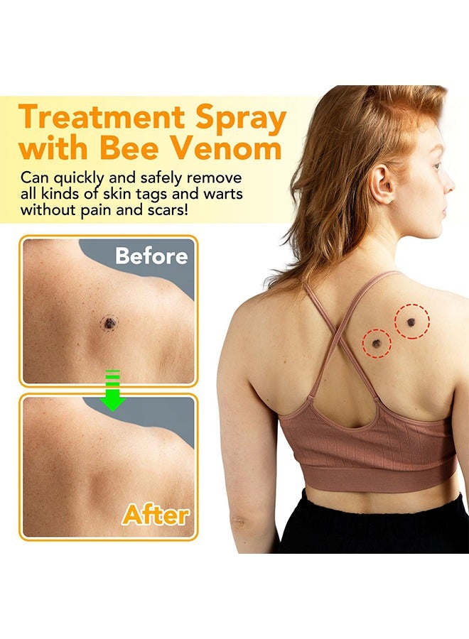 Sefudun Tag Recede Treatment Spray with Bee Venom - Bee Venom Wart Remover Spray Skin Tag Removal Safe and Painless Clear Skin Tag and Mole Skin Tag Remover for All Skin Types Tag Recede Bee Venom Spray 60ml  - Image 3