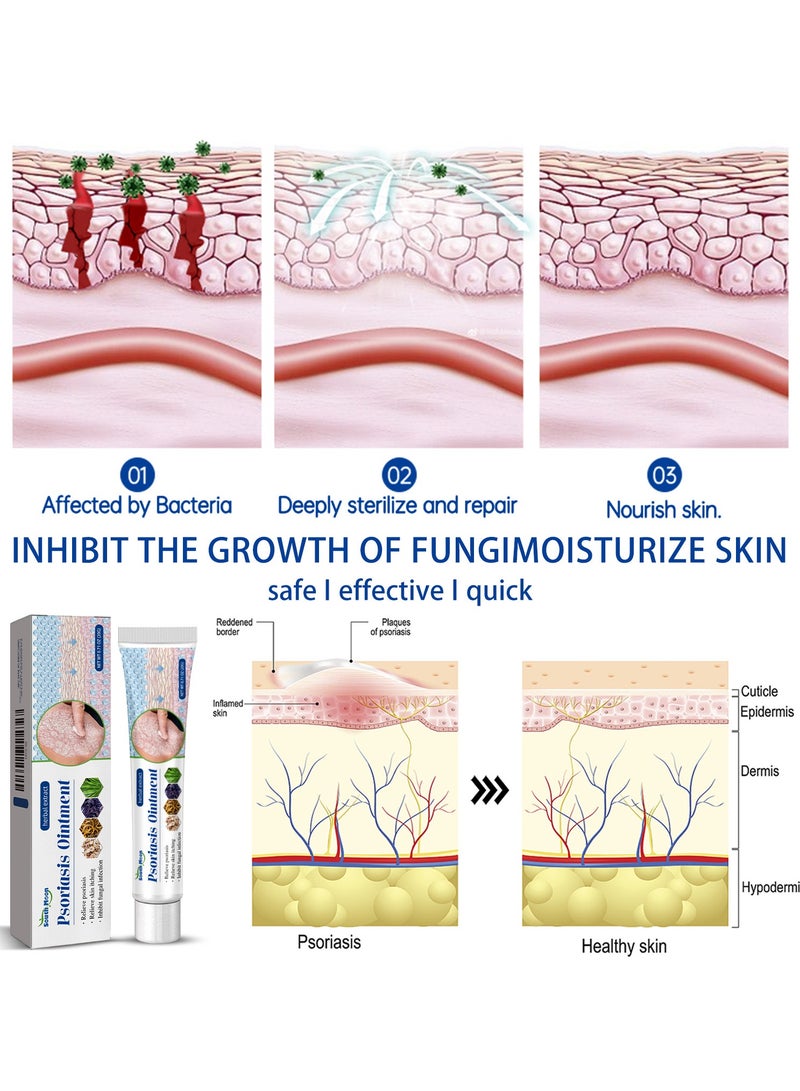 ساوث مون 2-Packs Psoriasis cream,External skin ointment, antibacterial ointment 20g*2 - Image 3