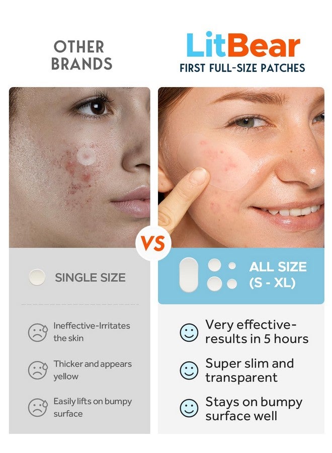 LitBear LitBear Large Acne Pimple Patches, 5 Sizes 80 Patches for Large Breakouts, Acne Patches for Face, Chin or Body, Acne Spot Patch with Tea Tree & Calendula Oil, Hydrocolloid Bandages for Acne Skin  - Image 3