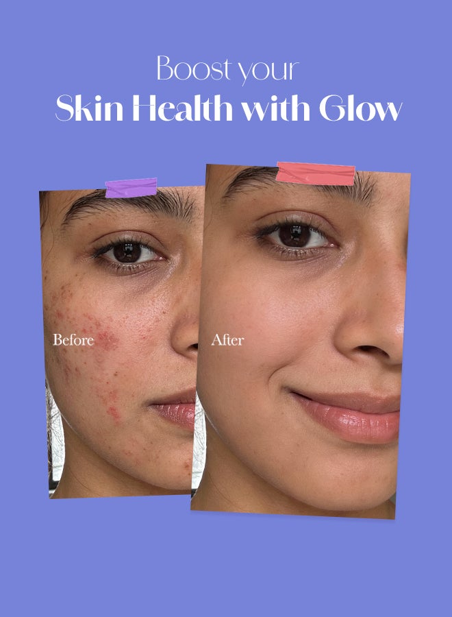 CHICNUTRIX Glow - Japanese Glutathione & Vit. C for skin radiance & even tone - 20 Effervescent Tablets, Blackcurrant & Lemon Flavour - Image 5