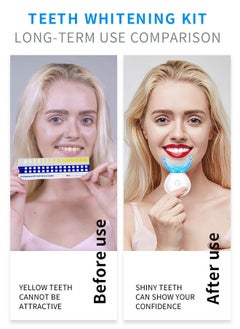 SMILEKIT Teeth Whitening Kit, Portable Wireless Teeth Whitening Device with  Gel Pens and LED Lights Accelerator Effective Removal Coffee Smoking Stains, Yellow Teeth  - Image 2