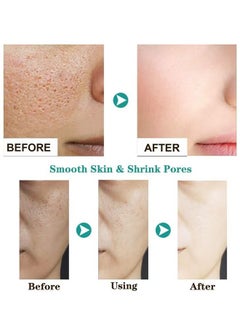 AuQuest Salicylic Acid Acne Face Cream Whitening Facial Treatment Hyaluronic Acid Black Dots Remove Skin Care Beauty Health Repairing Skin Base Essence 15ml  - Image 3
