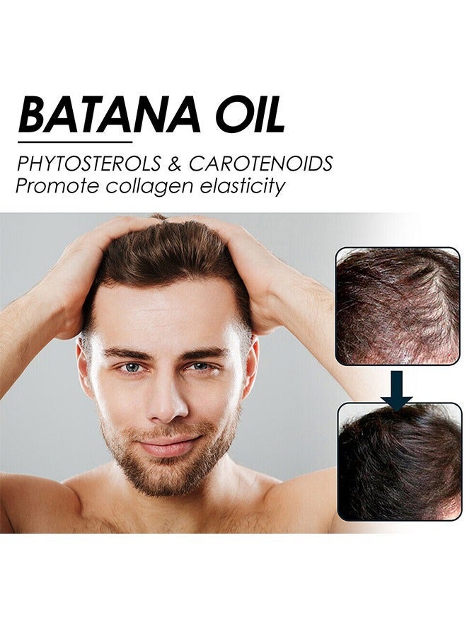 EELHOE Batana Oil - Batana Oil For Hair Growth - Batana Oil Organic for Healthy Hair - Repair Damaged Hair, Nourishes Thin Hair Scalp Skin and Loss Hair Growth Fir for All Hair Types - 30 ml - Image 2