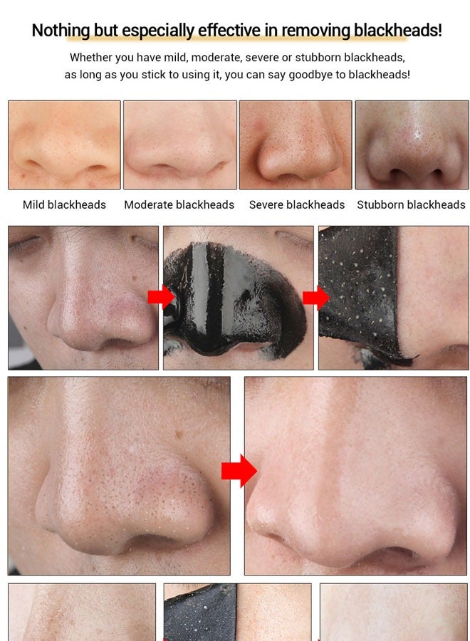 LANBENA 5 PCS Blackhead Remover Mask（Nose） Bamboo Charcoal Blackhead Removal Mask, Deep Cleansing Nose Pores + Oil Control + Moisturizing / Farewell Strawberry Nose - Image 5