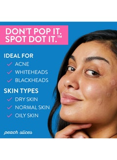 Peach Slices Acne Spot Dots Hydrocolloid Acne Patches For Zits Blemishes & Breakouts Vegan Crueltyfree Pimple Patches Facial Skin Care Products 3 Sizes (7Mm 10Mm & 12Mm) 30 Ct  - Image 2