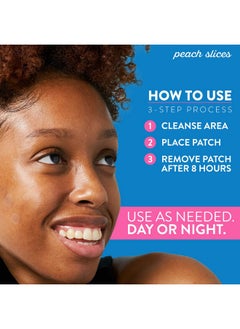 Peach Slices Acne Spot Dots Hydrocolloid Acne Patches For Zits Blemishes & Breakouts Vegan Crueltyfree Pimple Patches Facial Skin Care Products 3 Sizes (7Mm 10Mm & 12Mm) 30 Ct  - Image 4