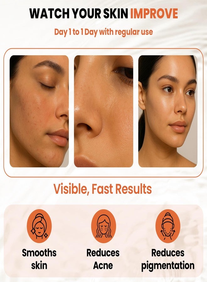iCUC Nutmeg Skin Rejuvenating Face Serum 30ml - with Licorice Extract & Hyaluronic Acid - Improves Skin Hydration- Supports In Reducing Acne and Scars - Promotes Youthful Skin- For Women & Men - Pack of 1 - Image 5