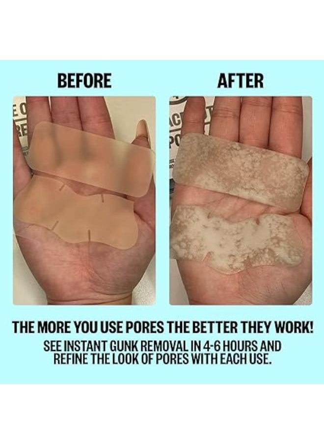 PEACE OUT - Poors Pore Nose Detox Strips 48.72g - Image 1