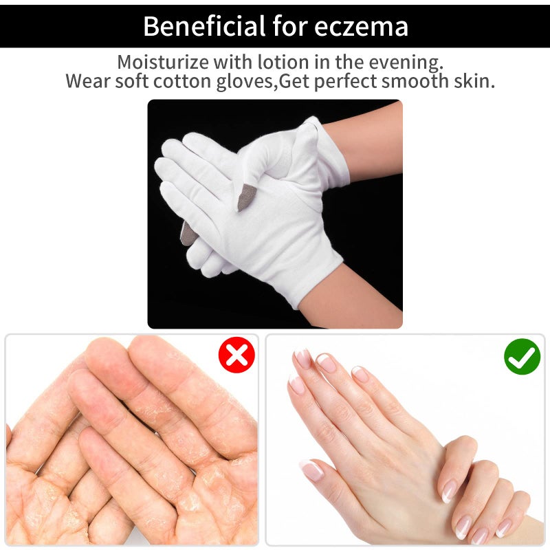 Sibba 2 Pairs Touch Screen Moisturizing Gloves White Cotton Moisturizing Gloves Overnight Bedtime Heal Eczema Sleeping Lotion Hand Spa Treatment Gloves Repair Rough Cracked Dry Chapped Hands Skin - Image 5