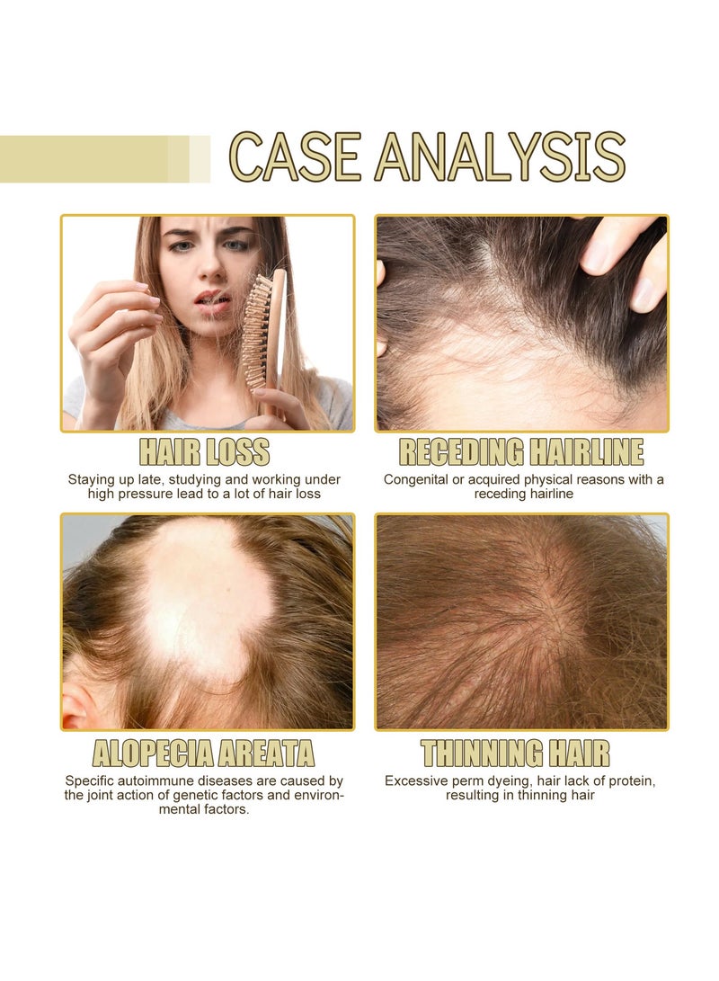 إيلهو زيت الروزماري للعناية بالشعر يصلح الشعر التالف، يمنع تساقط الشعر، ينعم الشعر، يغذي الشعر، 60 مل - Image 4