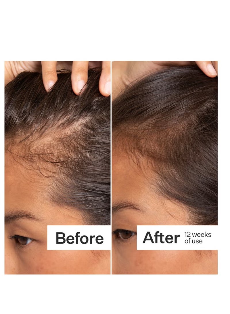 Act+Acre 3 Pack 2% Stem Cell H-2 Grow Complex Scalp Serum for Thicker-Looking Hair - Image 3
