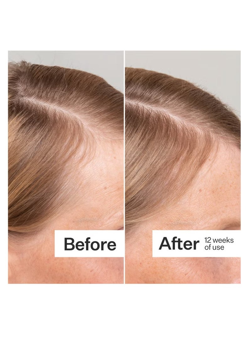 Act+Acre 3 Pack 2% Stem Cell H-2 Grow Complex Scalp Serum for Thicker-Looking Hair - Image 4