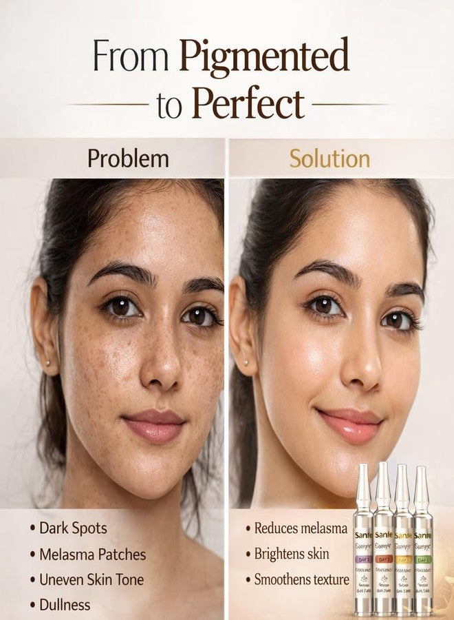 Sanfe PigmentReset 5 Day Melasma Cure Kit – Targeted Brightening Ampoules with Kojic, Niacinamide, Glutathione, Vitamin C & Alpha Arbutin for Dark Spots, Uneven Skin Tone & Radiant Complexion (5 x 5ml) - Image 1