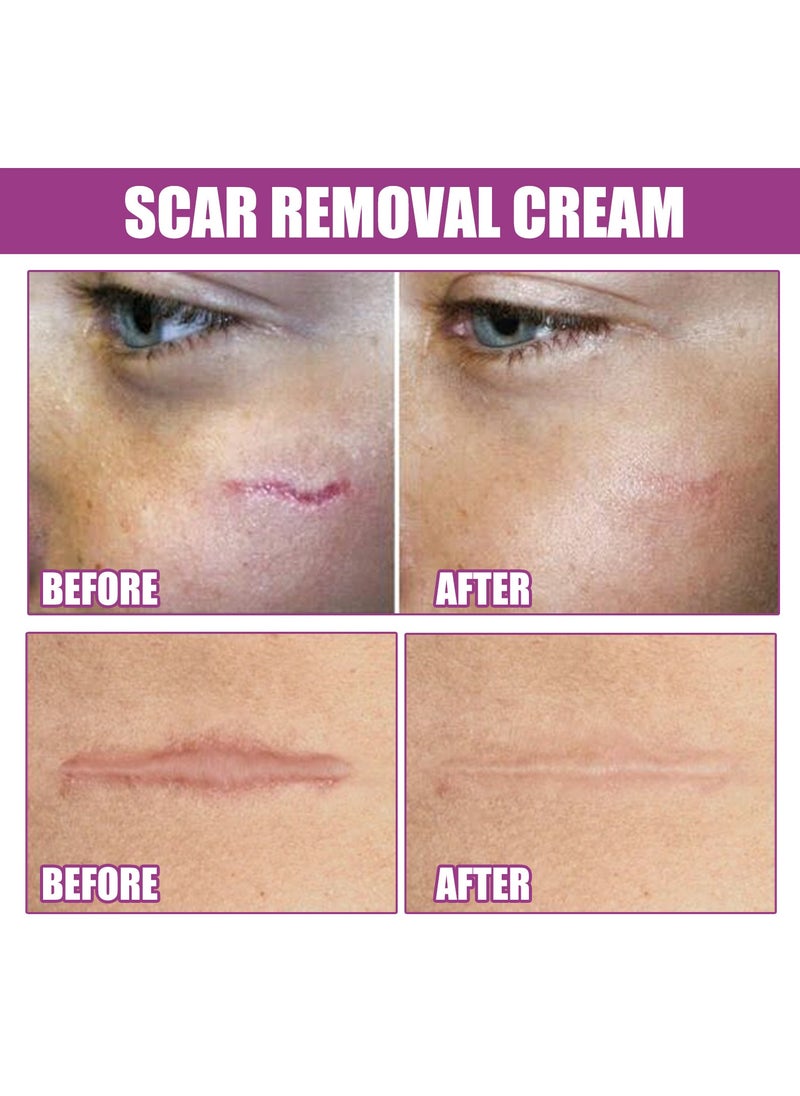 OUHOE - Scar Repair Cream Fades Surgical Scars Smoothes Skin Repairs Wounds and Skin - Image 1