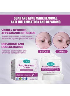 Scar Repair Cream Fades Surgical Scars Smoothes Skin Repairs Wounds and Skin