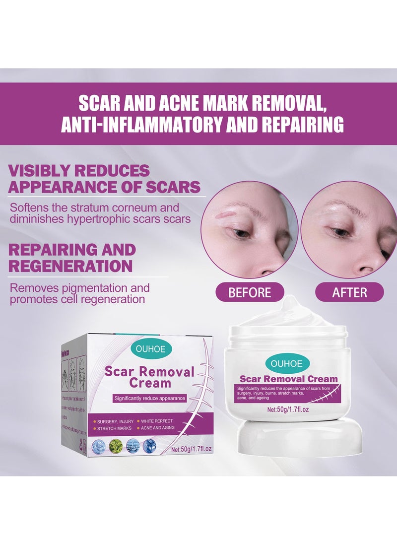 OUHOE - Scar Repair Cream Fades Surgical Scars Smoothes Skin Repairs Wounds and Skin - Image 1