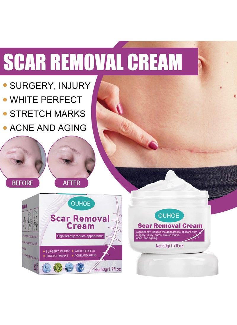OUHOE - Scar Repair Cream Fades Surgical Scars Smoothes Skin Repairs Wounds and Skin - Image 1
