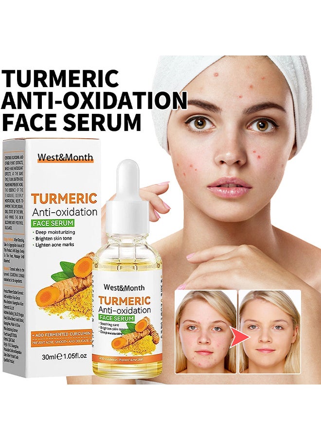 West&Month Turmeric Dark Spot Corrector Serum, Turmeric Repair Face Serum, Bright Skin Dark Spot Corrector Face Whitening Serum, Hydrate Dull And Dry Skin 30ML  - Image 2