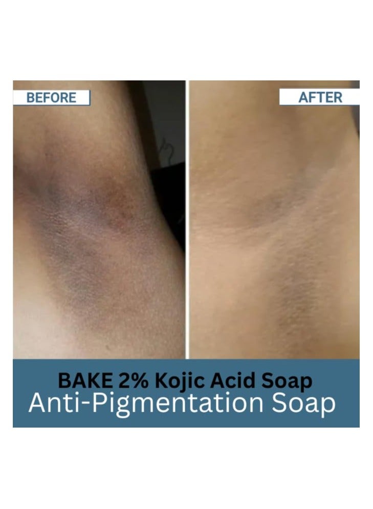 BAKE 2% Kojic Acid Scrub Treatment Soap (200 Gms) for Pigmentation, Dark Spots, Tan Removal, Brightens Underarms | With Alpha Arbutin, Lactic Acid & Niacinamide | Soap for Women & Men | 100g x 2 - Image 3