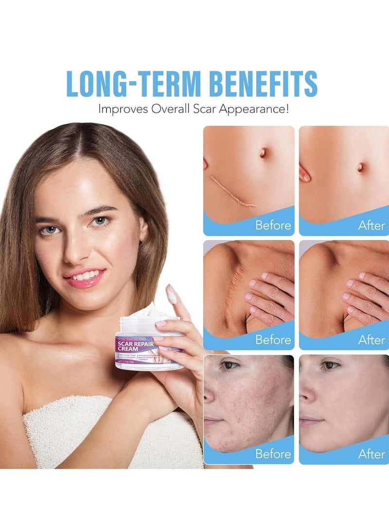 VOGSIG 50g Scar Removal Cream for Damaged Skin Surgery Scar Dead Skin Elimination Acne Scars Insect Bites and Pregnancy Lines Moisturizing and Skin Repair Reduce Scars and Mark Scar Repair Cream - Image 3