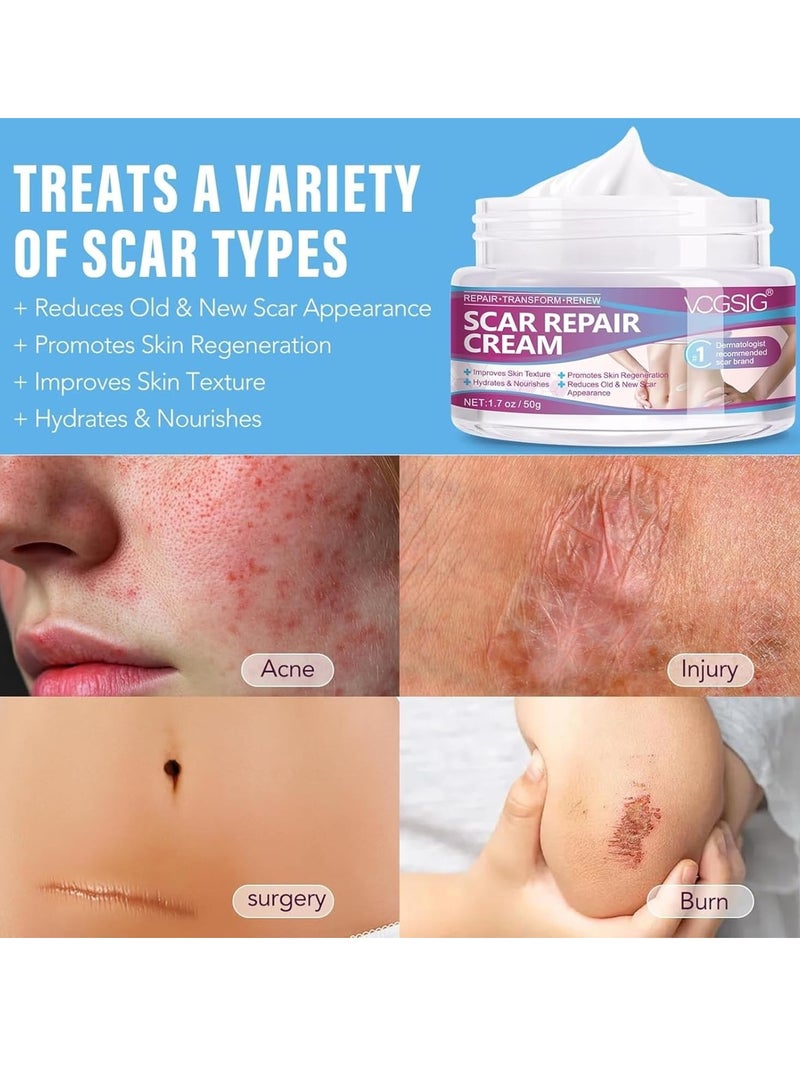 VOGSIG 50g Scar Removal Cream for Damaged Skin Surgery Scar Dead Skin Elimination Acne Scars Insect Bites and Pregnancy Lines Moisturizing and Skin Repair Reduce Scars and Mark Scar Repair Cream - Image 5