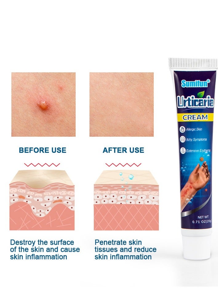Sumifun Itching Cream, Maximum Strength Anti-Itch Cream, Urticaria Pruritus Ointment for Dry Skin Adjunctive Treatment Microbiome Maintaining, Intensive Healing Formula 20g - Image 3