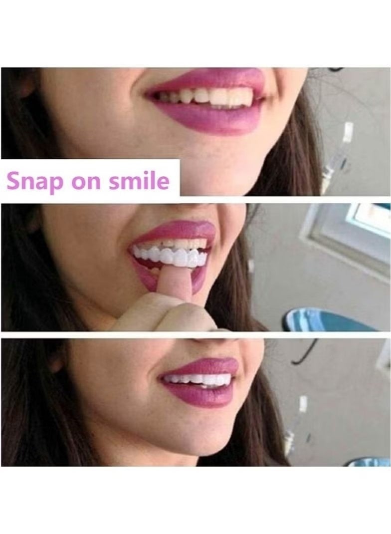 NH Generic Snap-On Smile Veneers | Removable Teeth Covers for Whitening & Alignment | Alternative to Braces | For Men & Women - Image 3