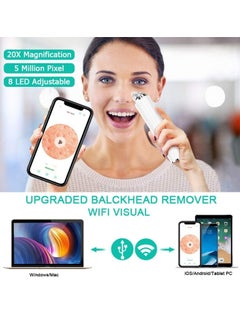OASIS-TH Black Head Pimple Vacume Removal with camera  Pore Vacuum Cleaner Blackhead Suction Tool, 20X Microscope Camera Rechargeable Facial Comedone Acne Extractor for Men Women  - Image 3