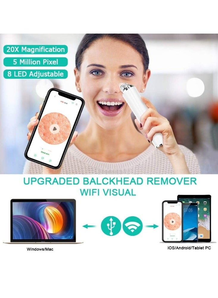 OASIS-TH Black Head Pimple Vacume Removal with camera  Pore Vacuum Cleaner Blackhead Suction Tool, 20X Microscope Camera Rechargeable Facial Comedone Acne Extractor for Men Women  - Image 3