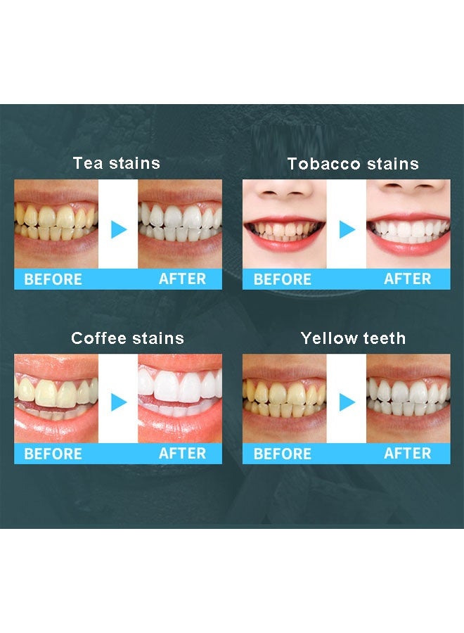 SMILEKIT Teeth Whitening Kit - Image 4